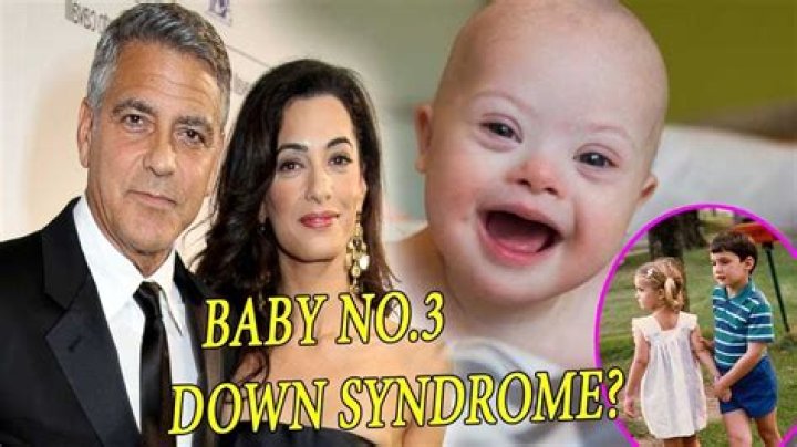 Meet The Clooney Twins: Embracing Down Syndrome