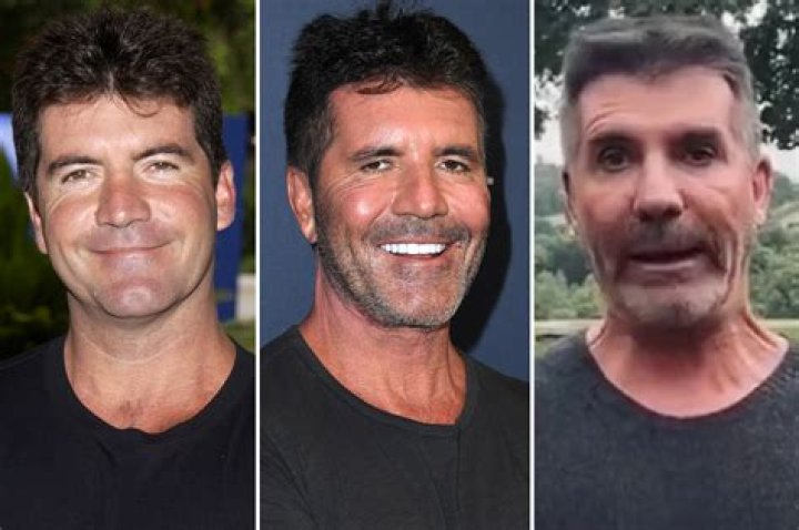 Simon Cowell's Eye: The Truth About His Vision Loss