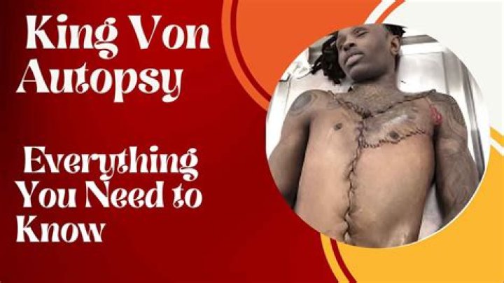 Unraveling The Mystery: The Autopsy Of Rapper King Von