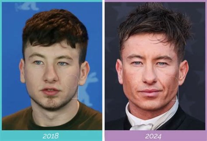 Unveiling Barry Keoghan: The Rising Star With A Unique Edge